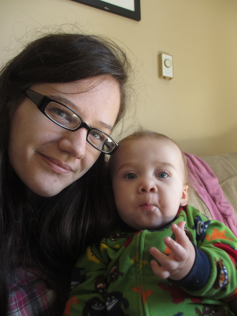 Hair Breakage And Ehlers Danlos Syndrome