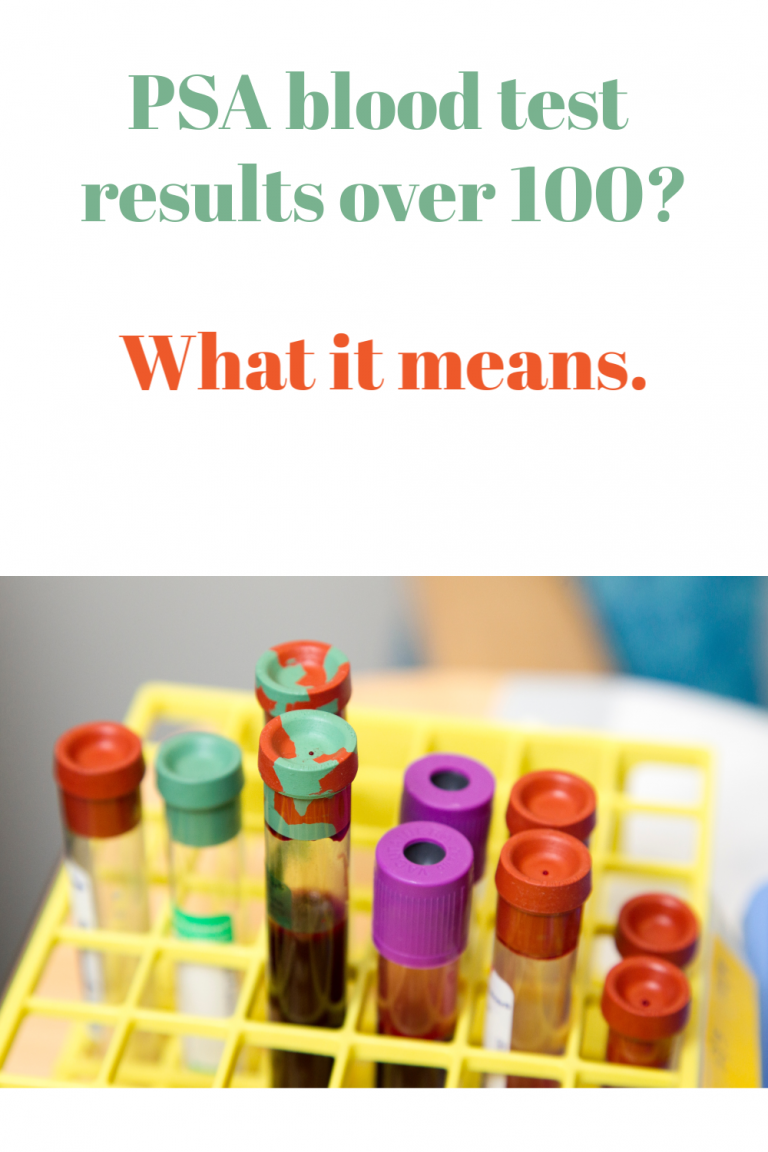 PSA Level Over 100 Prognosis Frank Loves Beans